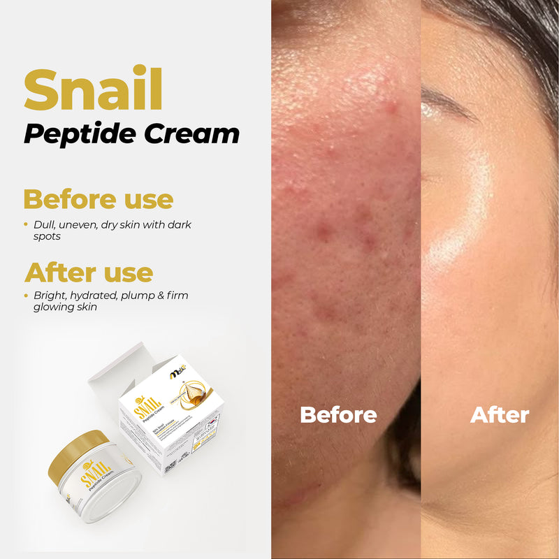 Snail Peptide Cream - 92% Snail Secretion Filterate