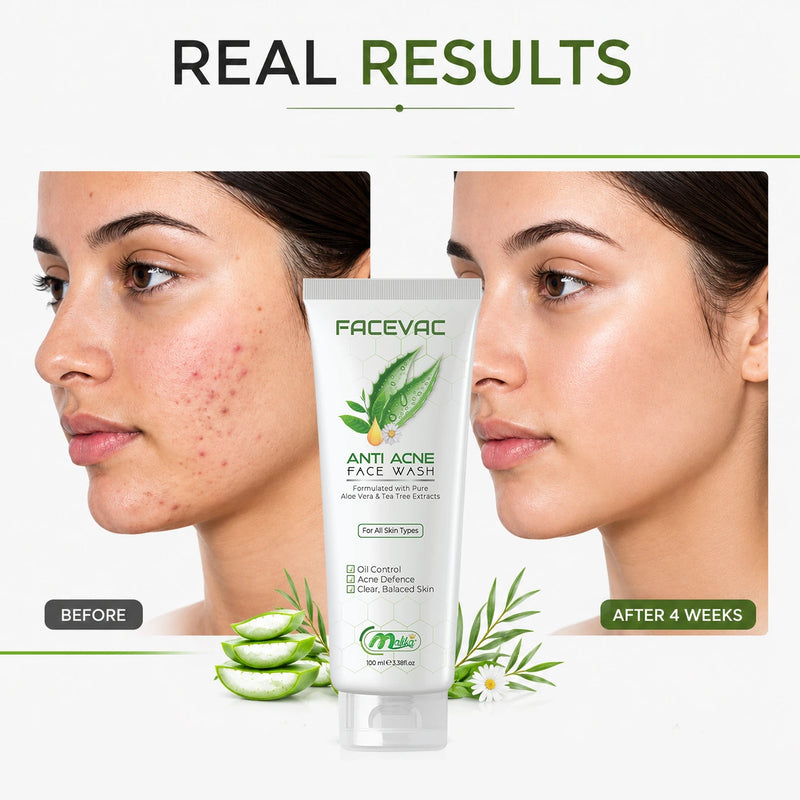 FaceVac- Anti-Acne Facewash