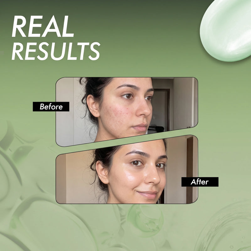 Centa Vac Advance Serum Lotion with 10x Soothing Care