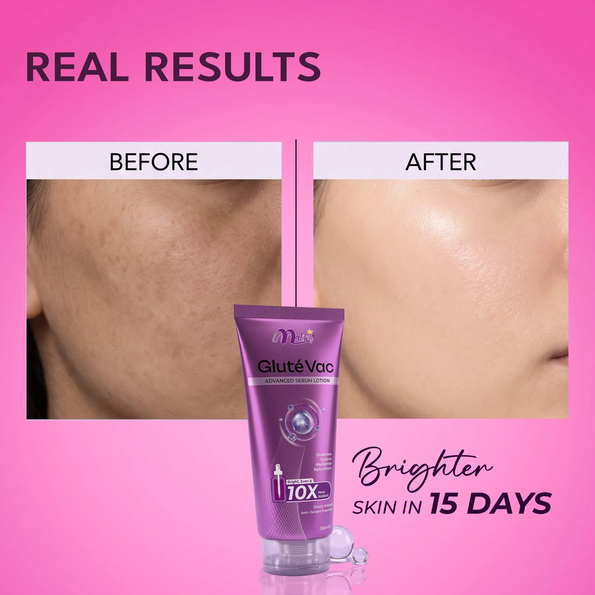 Gluté Vac Advance Serum Lotion with 10x Bright & Even Care