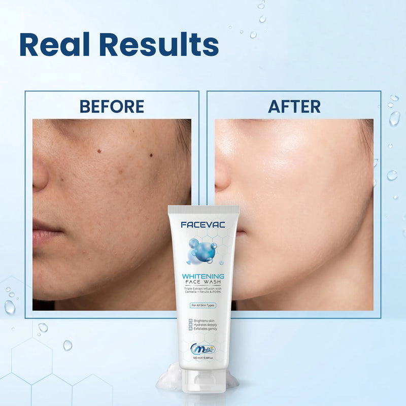 FaceVac- Whitening Facewash