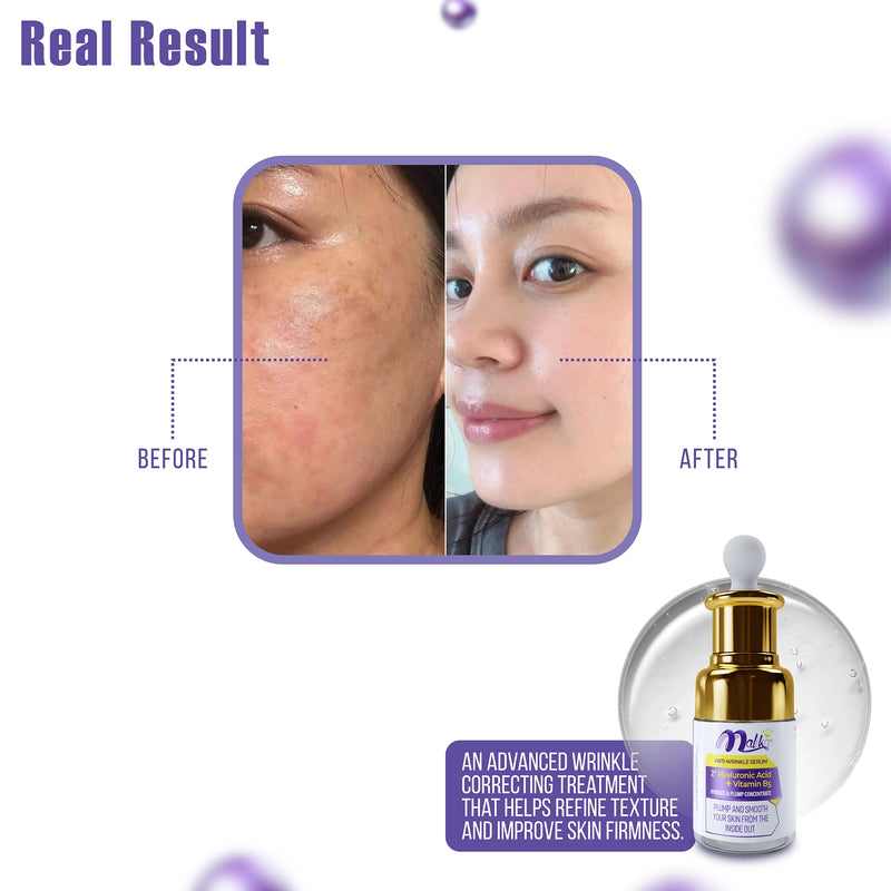 Hyaluronic Acid Anti-Wrinkle Serum