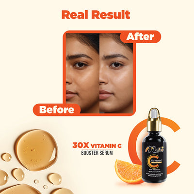 Buy 1 Get 1 Offer 30X Vitamin C Serum