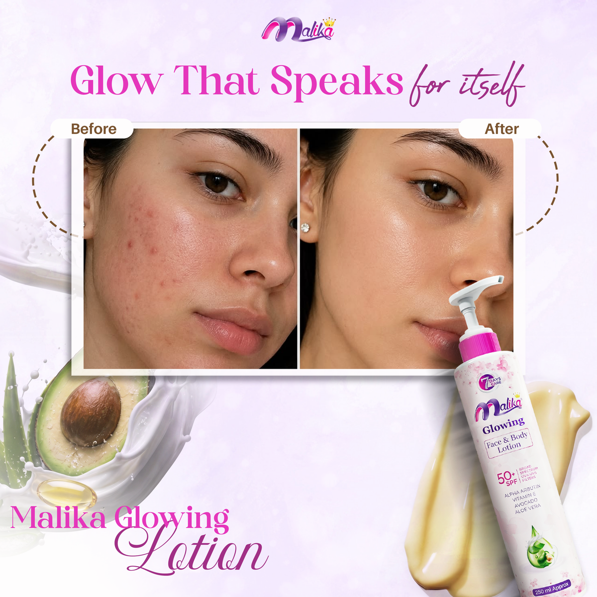 Buy 1 Get 1 Offer Malika GLOWING Face & Body Lotion